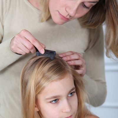 Head Lice Removal And Prevention