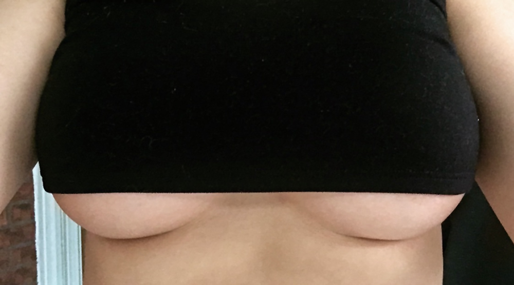 Breast Augmentation Surgery