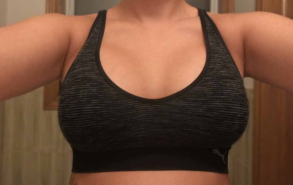 Breast Augmentation Journey: Breast Augmentation Surgery + Recovery